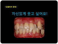 삐뚤삐뚤한 치…