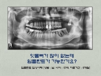 잇몸뼈가 없는…