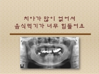 치아가 너무 없…