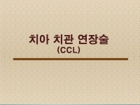 치관확장술(CCL)