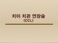 치관확장술(CCL)