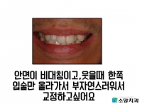 안면이 비대칭…