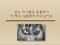남은치아가 흔…