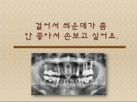 걸어서 씌운곳…