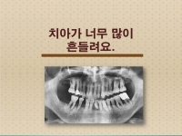 치아가 너무 많…
