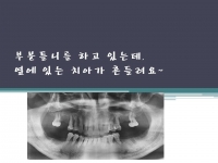 이가 흔들려요,…