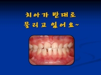 치아가 반대로 …