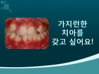 가지런한 치아 …