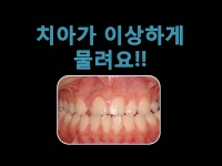 치아가 이상하…