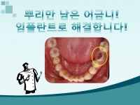 뿌리만 남은 어…