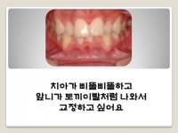 앞니가 토끼이…