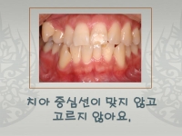 중심선이 맞지 …