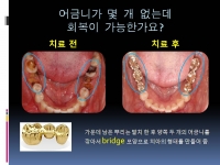 브릿지 진료사…