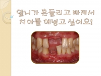 흔들거리는 앞…